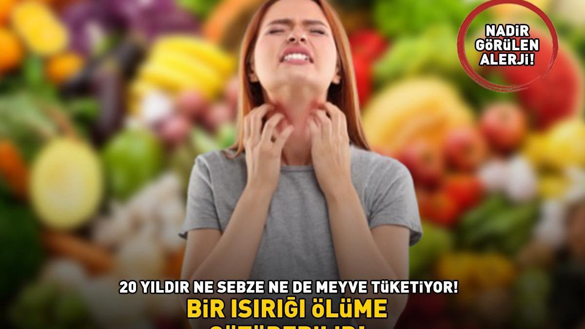 BİR ISIRIĞI ÖLÜME GÖTÜREBİLİR! Nadir görülen alerji kabusu oldu! 20 yıldır ne sebze ne de meyve tüketiyor!